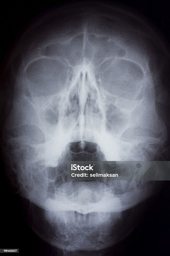 X 線画像の人の頭蓋骨 - X線撮影のロイヤリティフリーストックフォト