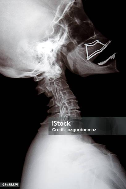 Photo libre de droit de Xray De Crâne Humain banque d'images et plus d'images libres de droit de Anatomie - Anatomie, Biologie, Cerveau humain