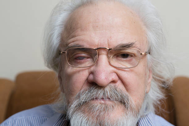 istock Lonely old man with sore eyes 984845602