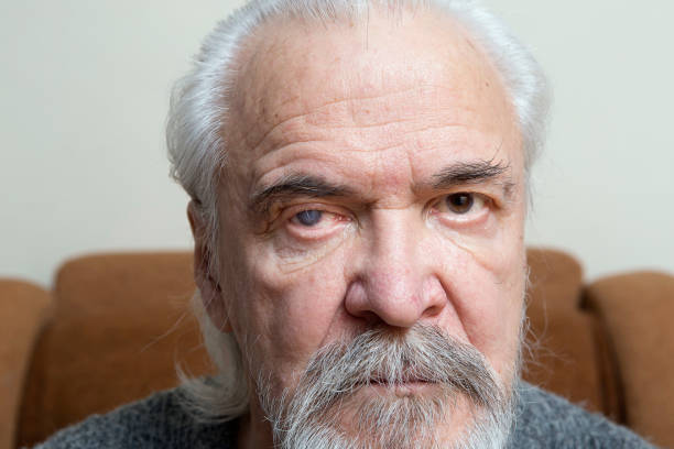 istock Lonely old man with sore eyes 984846526