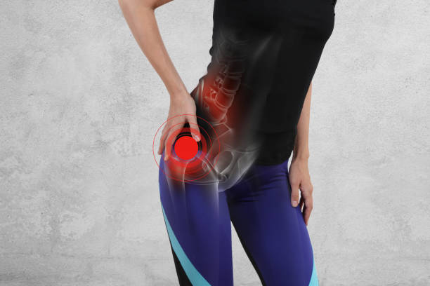 Woman with hip joint pain. Sport exercising injury stock photo
