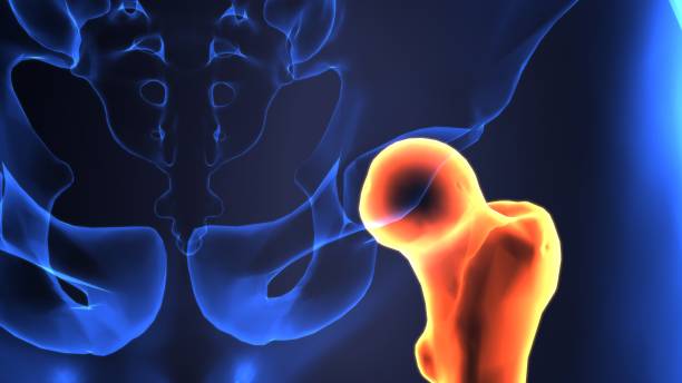 인간의 대 퇴 골 뼈 해부학의 3d 그림 - ischium 뉴스 사진 이미지