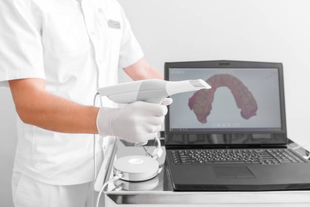 dental 3d scanner and monitor in the dentist's office - machine teeth imagens e fotografias de stock