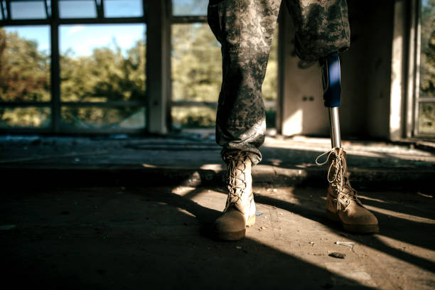 istock Soldier With Amputee Leg 987058670