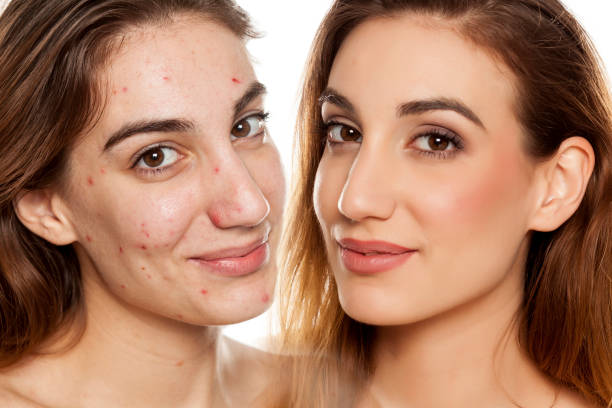 portrait de sélectionnés de la même femme avant et après maquillage amd traitement cosmétique sur fond blanc - floyd photos et images de collection