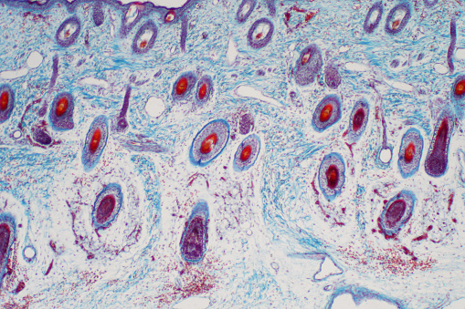 Cross section human skin tissue under microscope view for education