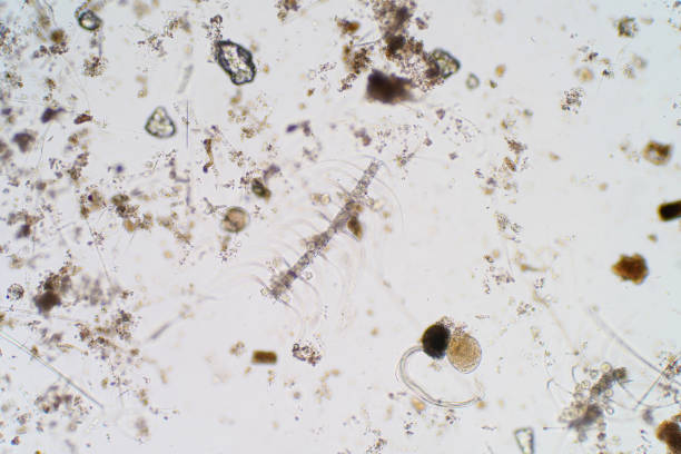 istock Marine aquatic plankton under the microscope view for education. 987992020