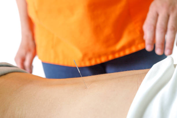 istock Acupuncture treatment in Asia 988133020