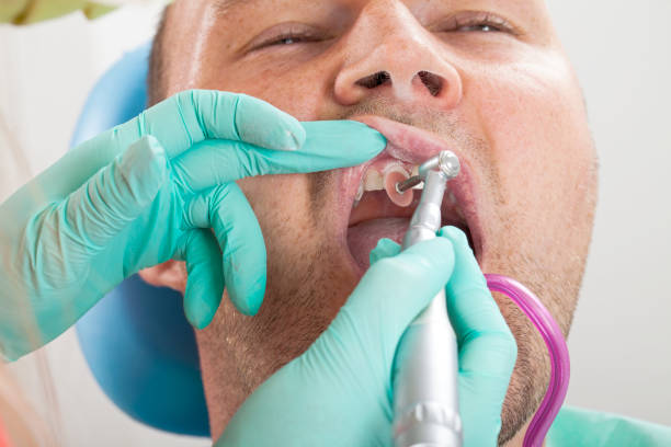 istock Dental treatment 988196450