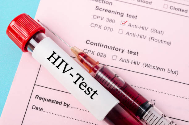 Sample blood collection tube with HIV test label Sample blood collection tube with HIV test label on HIV infection screening test form. hiv photos stock pictures, royalty-free photos & images