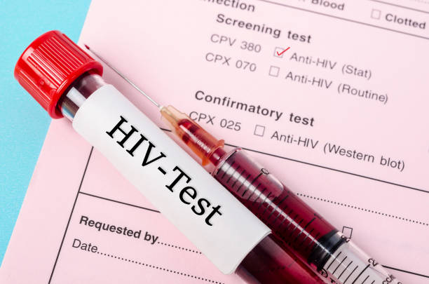 Sample blood collection tube with HIV test label Sample blood collection tube with HIV test label on HIV infection screening test form. aids stock pictures, royalty-free photos & images