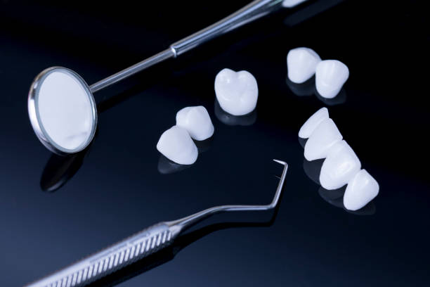 istock Dental tools and zircon dentures on a reflection surface - Ceramic veneers - lumineers 988721378