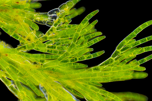 Microscopic view of green algae (Cladophora). Visible also diatoms cells. Darkfield illumination.