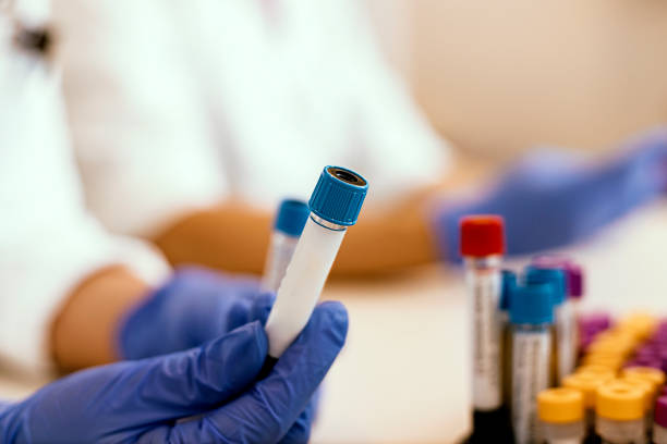 Scientist in research lab Working With Blood Samples in Laboratory, Closeup. Hand of a Lab Technician Holding Blood Tube. Science, Chemistry, Biology, Medicine and People Concept human centrifuge stock pictures, royalty-free photos & images