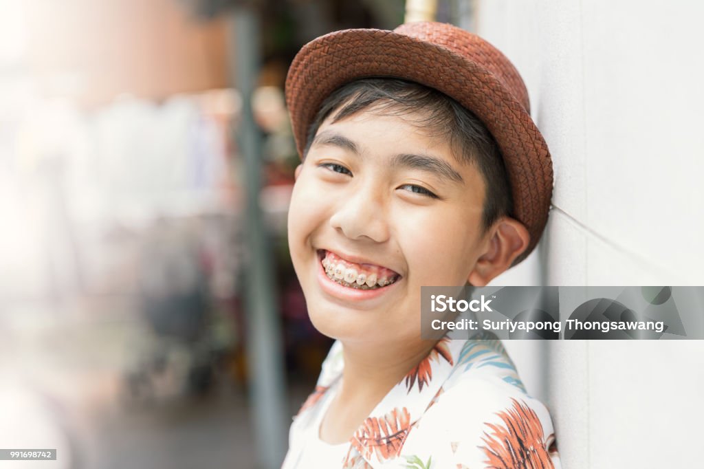 Asia teenager with teeth brace dental smiling and happy for lifestyle or healthcare concept background with vintage tone. Teenage Boys Stock Photo