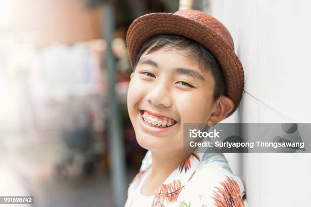 Asia Teenager With Teeth Brace Dental Smiling And Happy For Lifestyle Or Healthcare Concept Background With Vintage Tone Stock Photo - Download Image Now