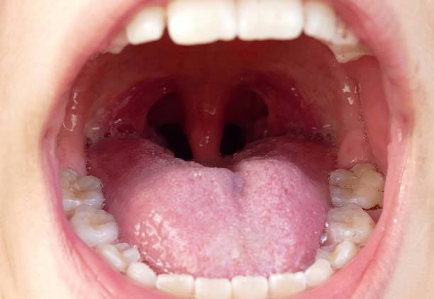 bambini con salute orale e tonsillite, - ugola foto e immagini stock