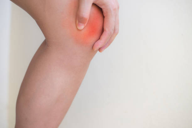 istock Arthritis knee joint get hurt and pain. 992734520