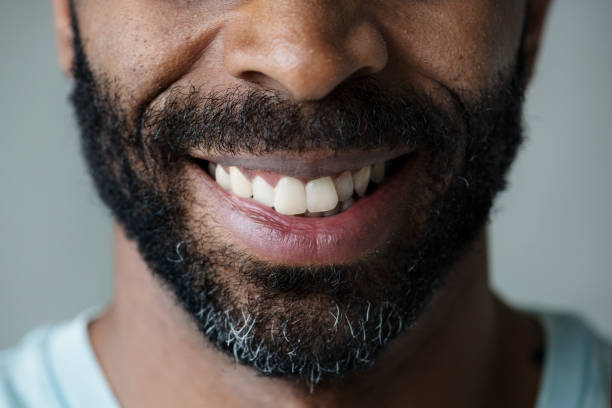 istock Closeup of smiling teeth of a black man 993673006