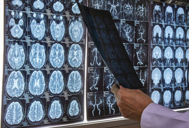 istock Doctor reading brain MRI in medical office 994273318