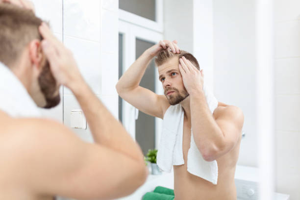 istock Handsome young man worried about hairloss 994274370