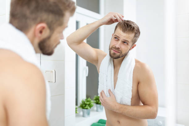 istock Handsome young man worried about hairloss 994276568