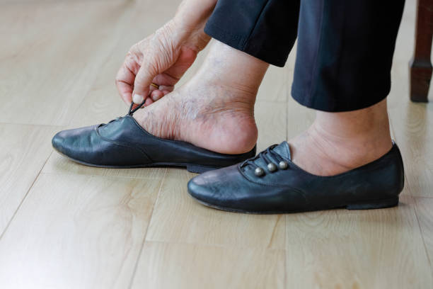 istock Elderly woman putting on shoes. 994318478