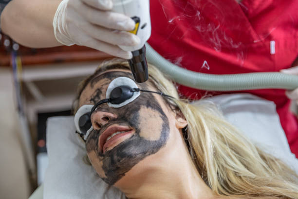 istock Young woman undergoing carbon peeling procedure in salon 994636998