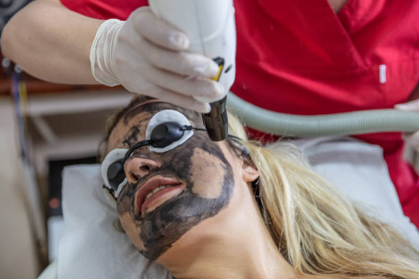 istock Young woman undergoing carbon peeling procedure in salon 994639202