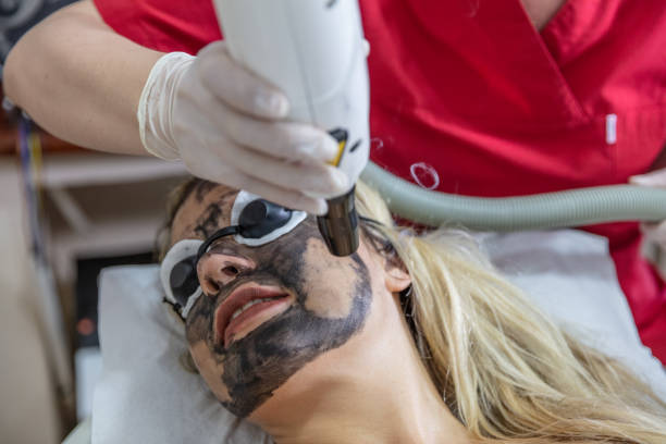 istock Young woman undergoing carbon peeling procedure in salon 994642020