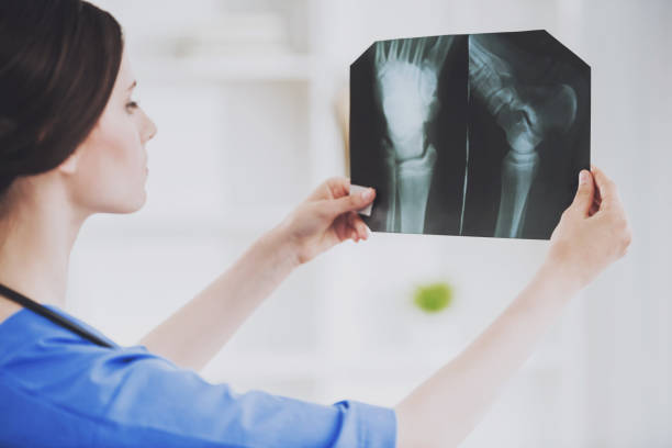 istock Young Doctor in Blue Uniform Check X-ray Scan. 994645330