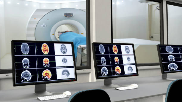 monitor de exploración médica - mri scanner medical scan cat scan oncology fotografías e imágenes de stock