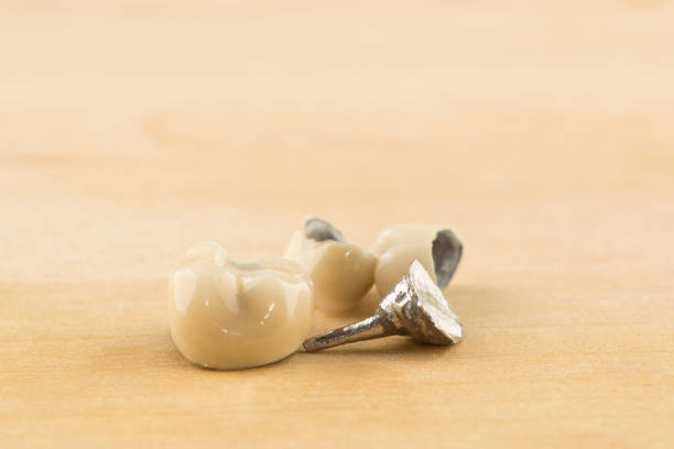 Dentist is working on facial dental prosthetic