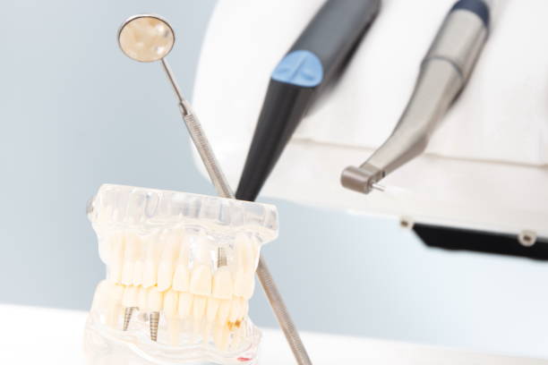 istock Dental jaw model, stomatology mirror and instruments used by dentists 995201402