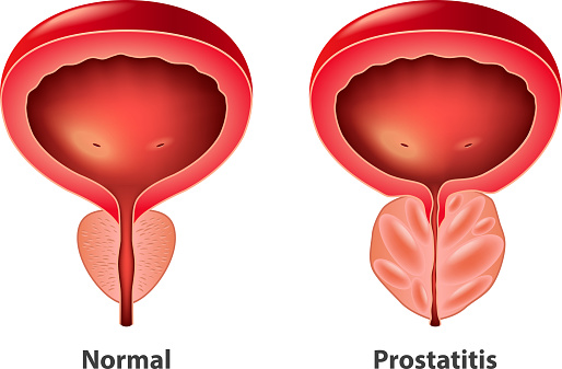 Manfaat Daun Kelor Untuk Prostat