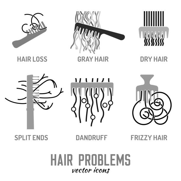 Hair Problem Icons Stock Illustration - Download Image Now - Hair,  Dandruff, Frizzy Hair - iStock