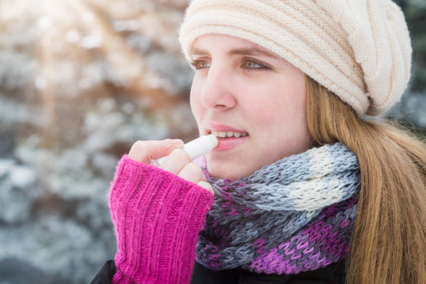 istock Woman protecting lips with lip balm on snowy day. 996000506