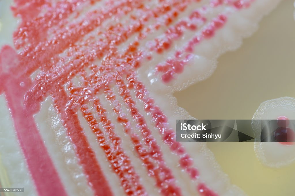 Serratia marcescens is a species of rod-shaped gram-negative bacteria in the family Enterobacteriaceae for Laboratory microbiology. Agar Jelly Stock Photo