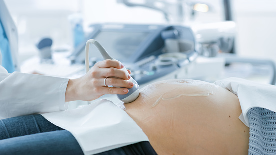 En el Hospital, el primer tiro del médico hacer ultrasonido sonograma de la exploración a una mujer embarazada. Obstetra moviendo el transductor en el vientre de la madre del futuro. photo