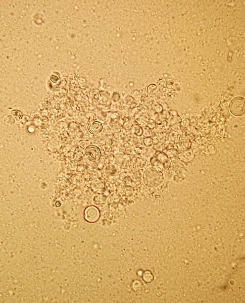 Microphotography of a suspension of aggregated artificial cells (liposomes) mdeMicrophotography of a suspension of artificial cells (liposomes) of micrometric size, aggregates, with detail of the bilipidic structures colloid stock pictures, royalty-free photos & images
