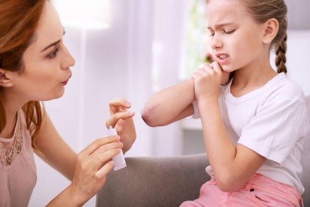 Nice pleasant woman looking at her daughters bruise Loving mother. Nice pleasant woman looking at her daughters bruise while applying ointment on it ointment photos stock pictures, royalty-free photos & images