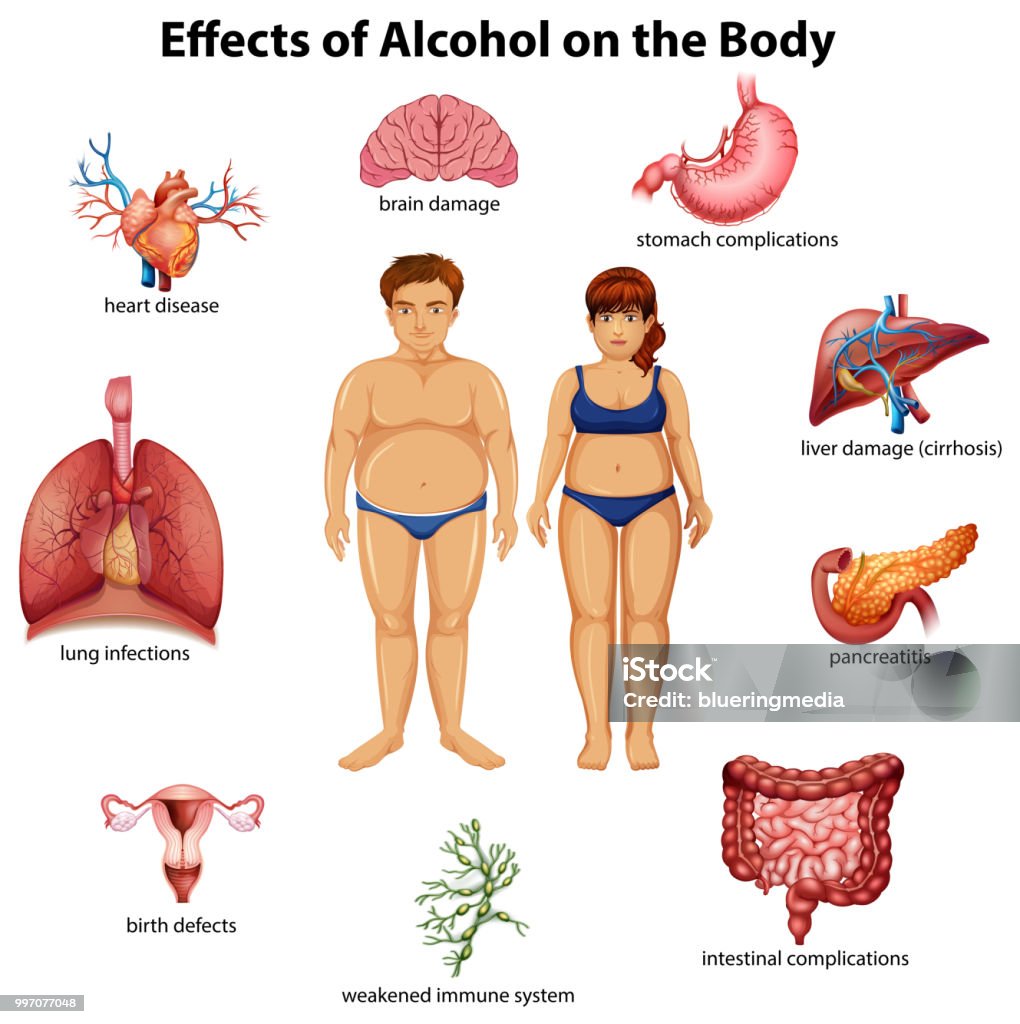 Effets de l’alcool sur le corps - clipart vectoriel de Alcool libre de droits