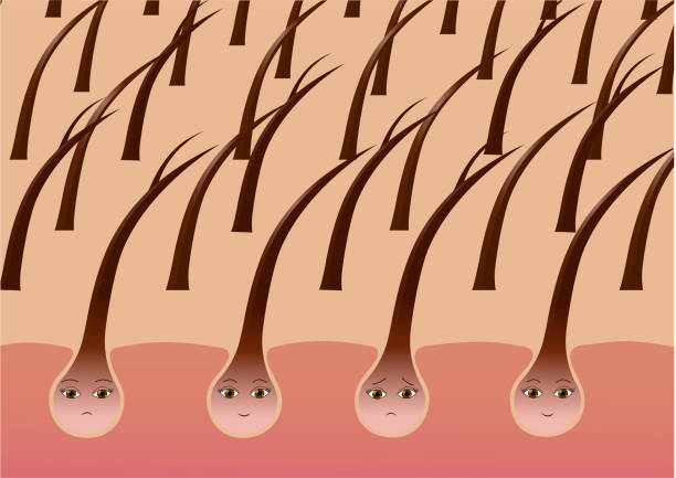 Cartoon Hair Follicles On The Scalp Suffering From Split Ends - Arte  vetorial de stock e mais imagens de Folículo capilar - iStock