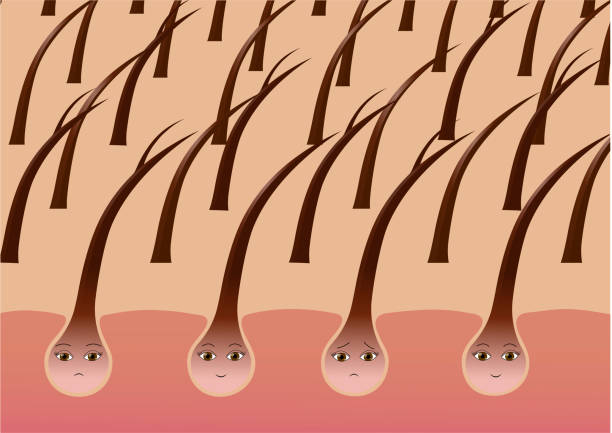 Cartoon hair follicles on the scalp suffering from split ends Cartoon hair follicles on the scalp suffering from split ends. Vector illustration weak cartoon stock illustrations