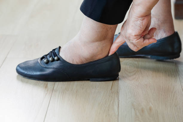 istock Elderly woman putting on shoes. 997790392