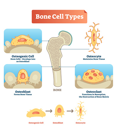 Vector illustration of human bone cell types. Scheme of osteogenic cell, osteoblast and osteocyte. Medical diagram visualization of stem cells, bone tissue, resorption and destruction of bone matrix.
