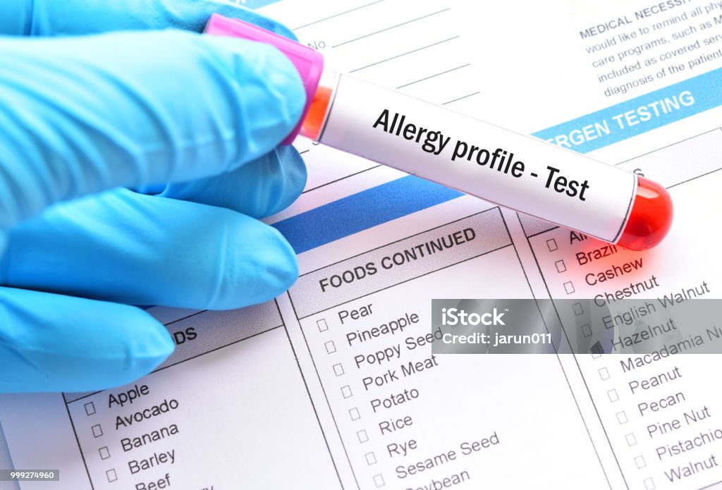 Blood sample tube for allergy profile test Blood sample tube with laboratory requisition form for allergy profile test Allergy Stock Photo