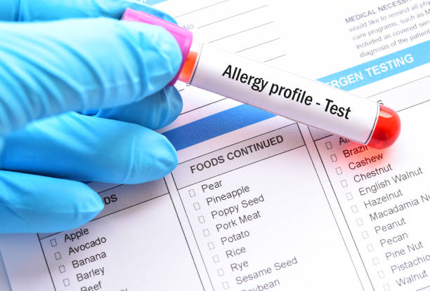 Blood sample tube for allergy profile test stock photo