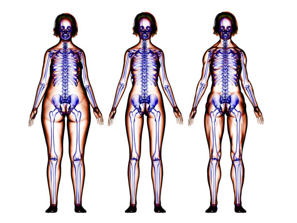 istock Fat, Slim, Muscular Women Bodies and Skeleton Systems 999868914