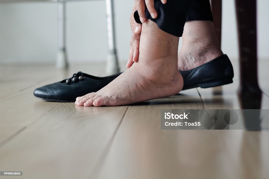 Femme âgée, les mettre sur les chaussures de pieds enflée - Photo de Enflure libre de droits